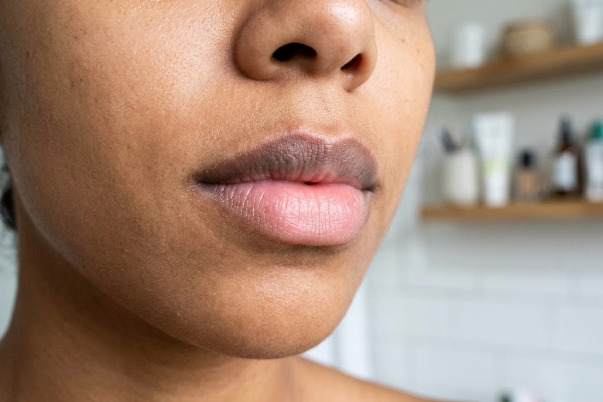 Why Your Lips Look Darker Than They Used To and What May Help