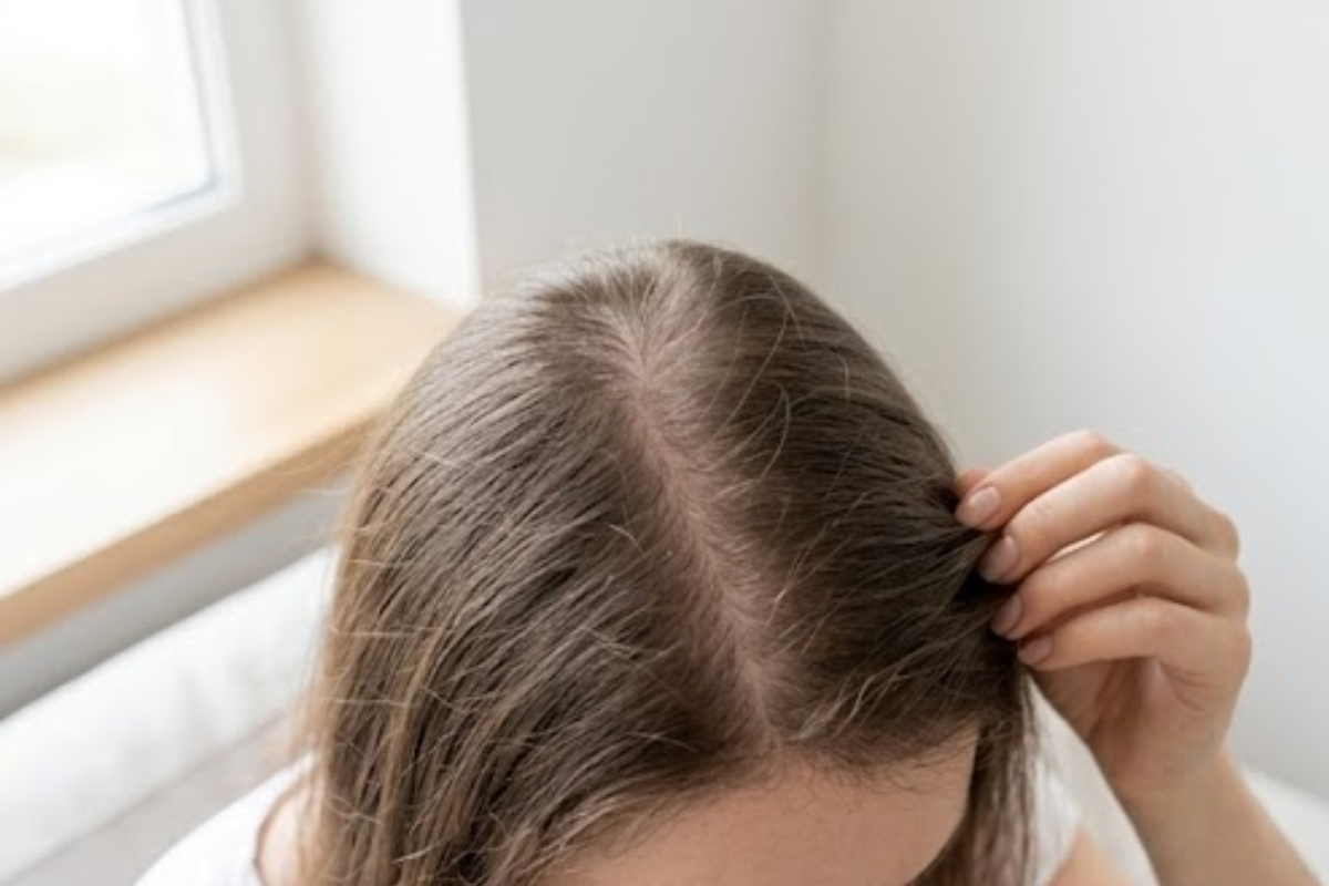 The Truth About Thinning Hair and What Can Help